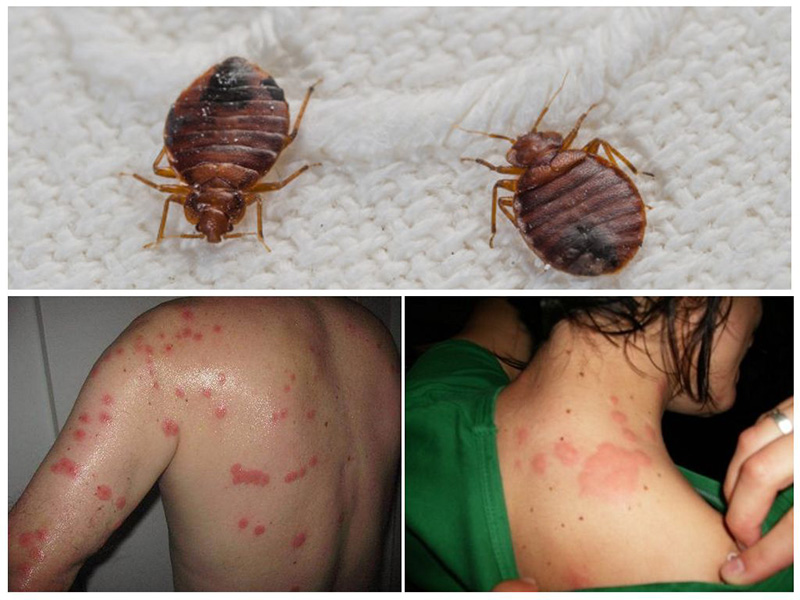 سبب ظهور البق في المنزل